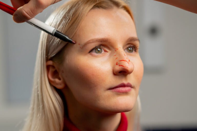 Rinoplastia: lo que nadie te cuenta sobre el postoperatorio