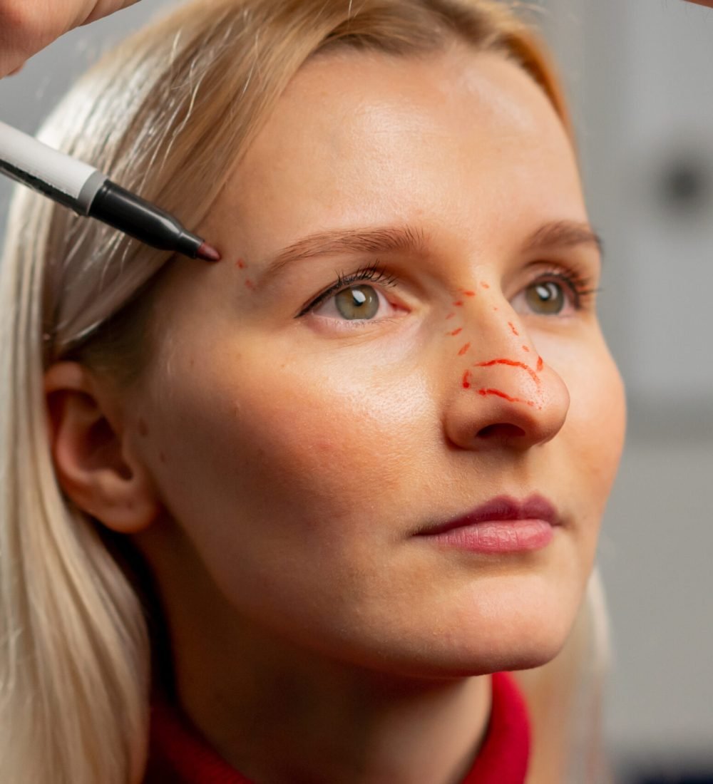 in a plastic surgery clinic doctor makes markings on the face of a young girl before surgery