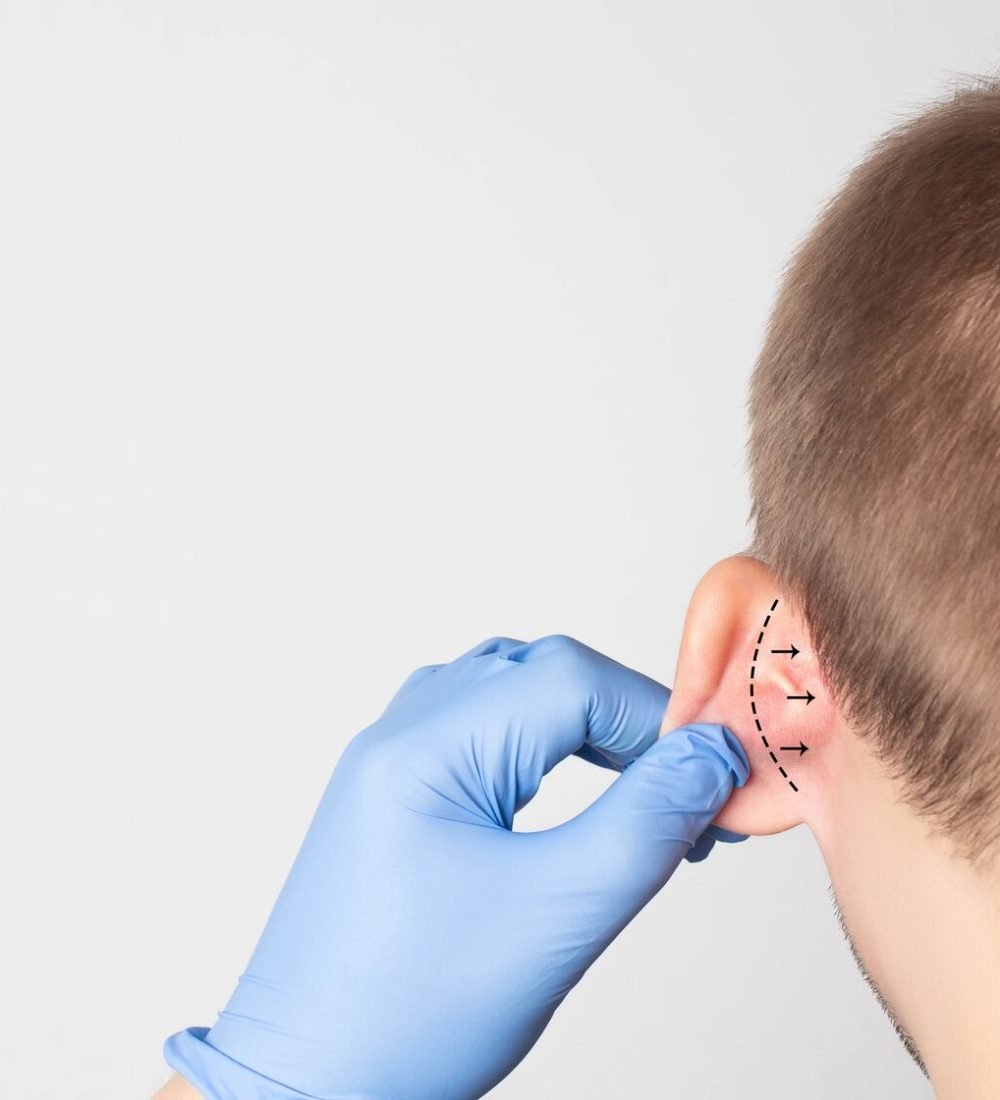 orejas-en-asa-uno-de-los-factores-que-mas-complejos-provocan-en-ninos-y-en-adultos-henadzy-stockadobecom-KF5CK7HBH5BUBESDKNQDOYZZMQ